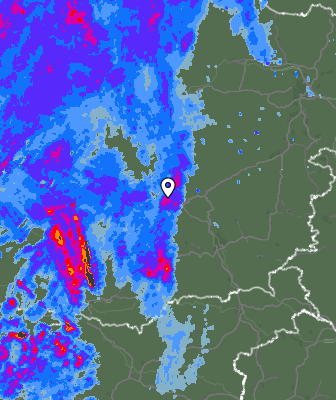 Radar