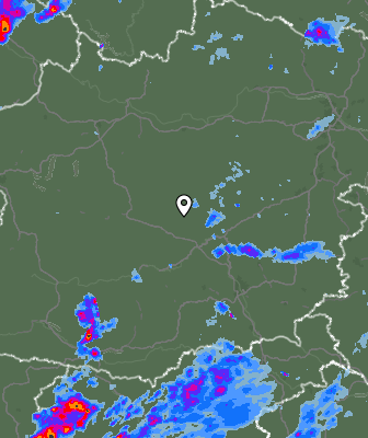 Radar
