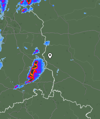 Radar