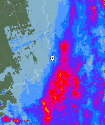 Radar