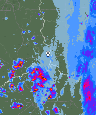Radar