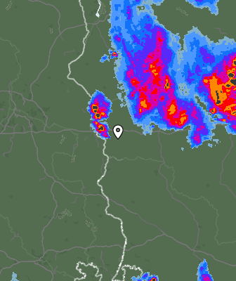 Radar