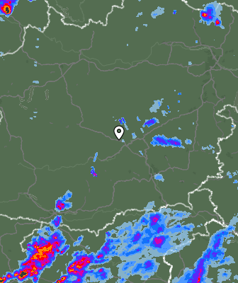 Radar