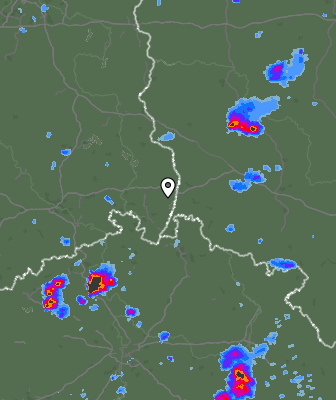 Radar