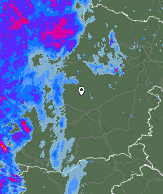 Radar