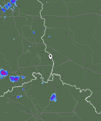 Radar