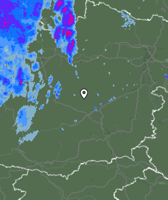 Radar