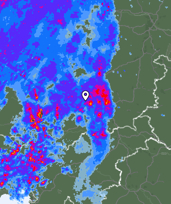 Radar
