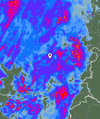 Radar