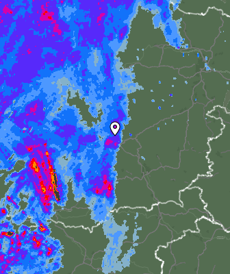 Radar