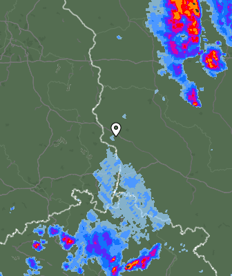 Radar