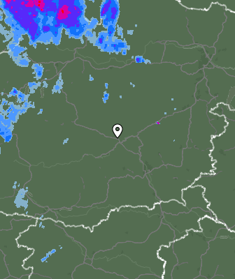Radar