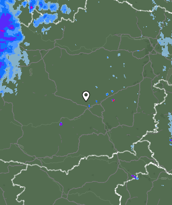Radar