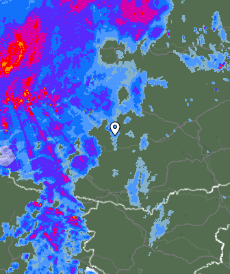 Radar