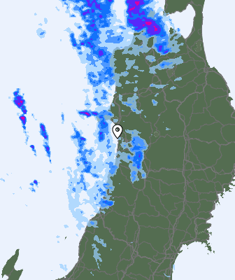 Radar