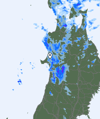 Radar