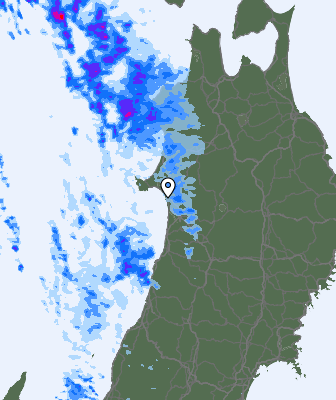Radar