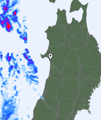 Radar