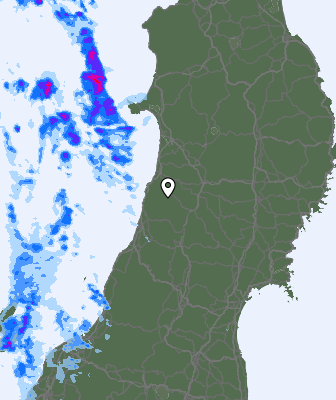 Radar