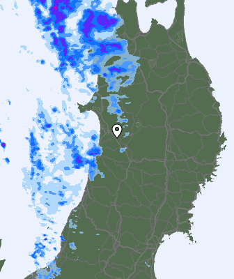 Radar