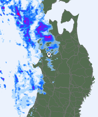 Radar
