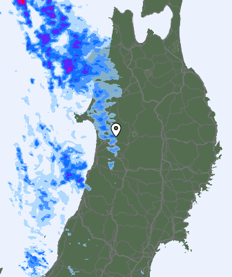 Radar