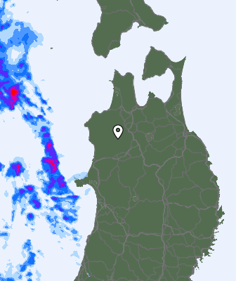 Radar