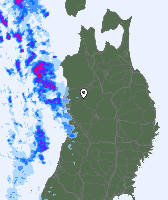 Radar