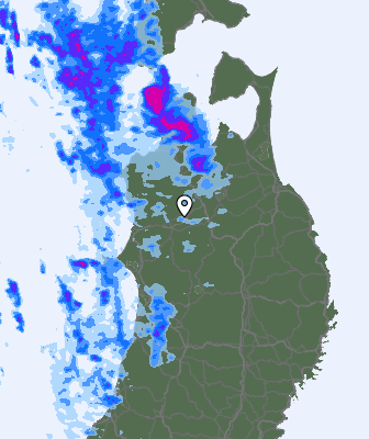 Radar