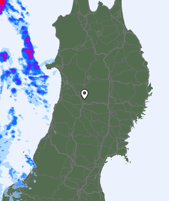 Radar