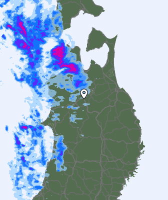 Radar