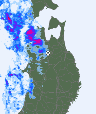 Radar