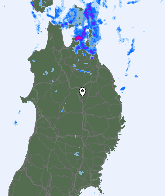 Radar