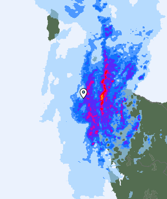 Radar