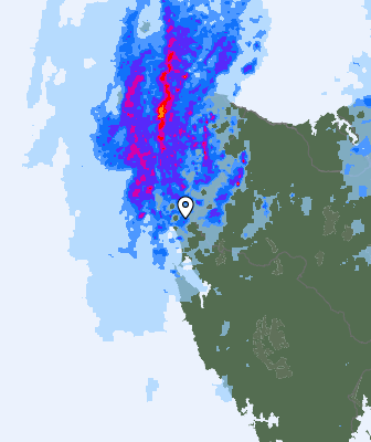 Radar
