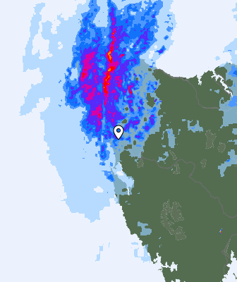 Radar