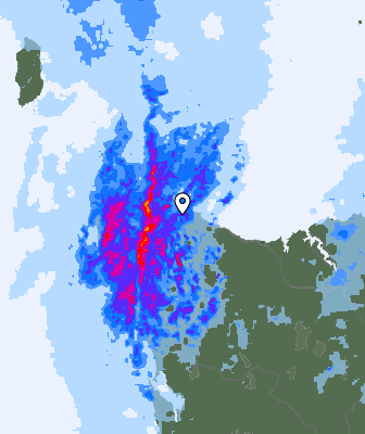 Radar