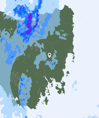 Radar