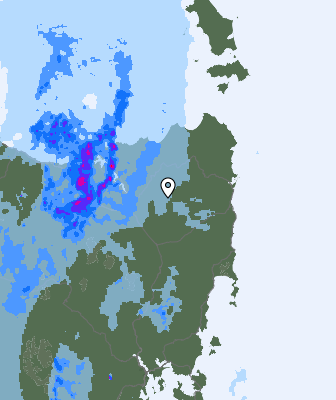 Radar