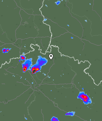 Radar