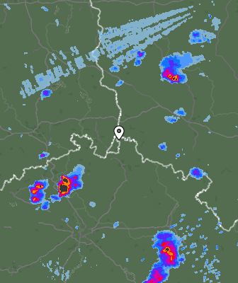 Radar