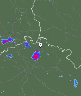 Radar