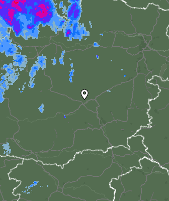 Radar