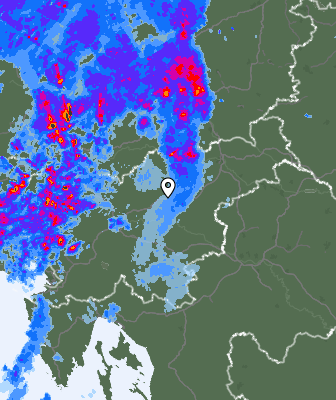 Radar