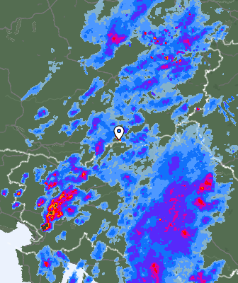 Radar