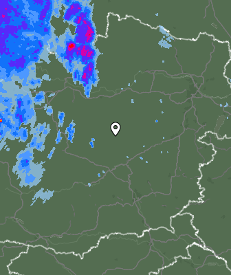 Radar