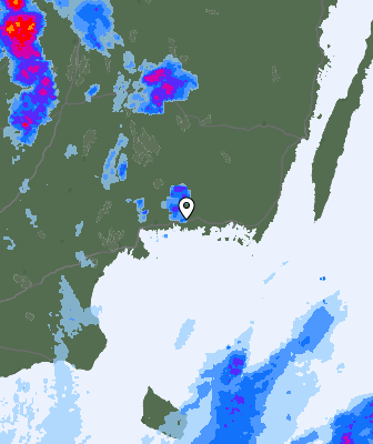Radar