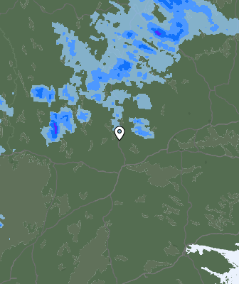 Radar