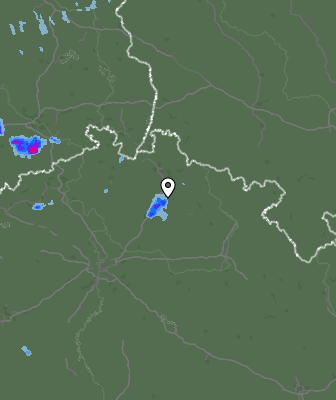 Radar