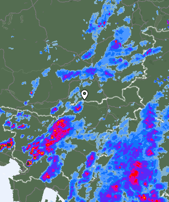 Radar